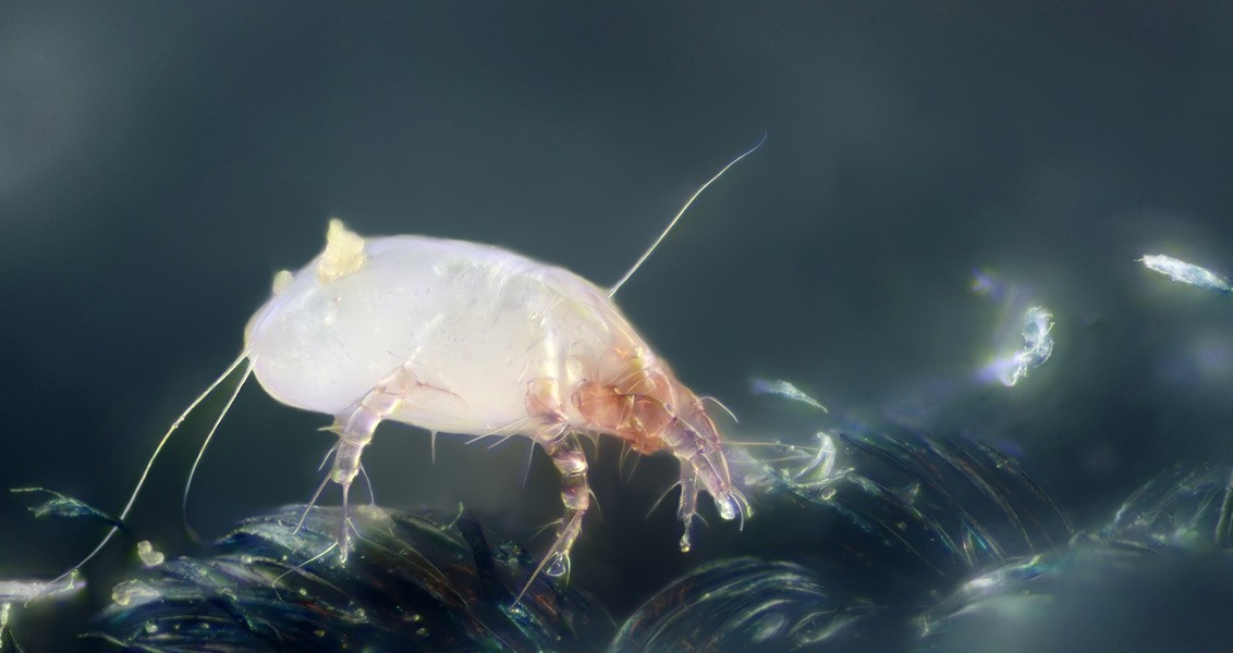 Poop in Your Pillow Dust Mites and Fungi Could Be Causing You Health